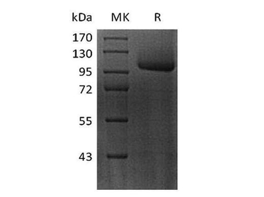 Recombinant Human FLT-3/FLK-2 Protein (Fc Tag) - ABMIUM