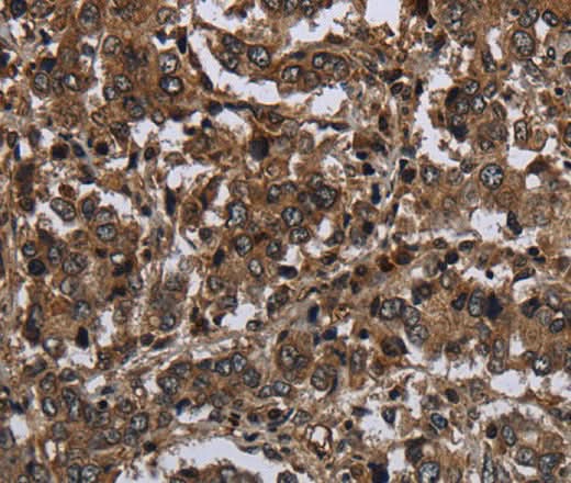 Anti-Human GLIPR1 Antibody - ABMIUM