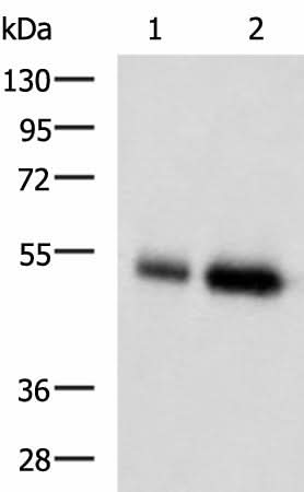 Anti-Human/Mouse BMP5 Antibody - ABMIUM