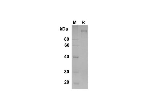 SDS-PAGE analysis of Human ICAM-5 proteins , 2 μg/lane of Recombinant Human ICAM-5 proteins was resolved with SDS-PAGE under reducing conditions , showing bands at 113 kDa.