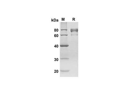 SDS-PAGE analysis of Human CA9 proteins, 2 μg/lane of Recombinant Human CA9 proteins was resolved with SDS-PAGE under reducing conditions, showing bands at 66.3 kDa.