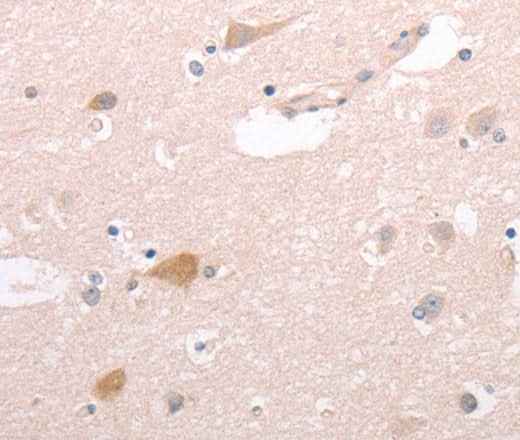 Anti-Human/Mouse CIDEB Antibody
