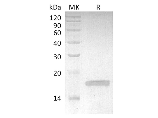 Recombinant Rabbit TNF-alpha/TNFSF2/TNFa Protein - ABMIUM