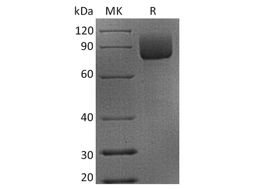 Recombinant Rhesus macaque CD19 Protein (Fc Tag) - ABMIUM