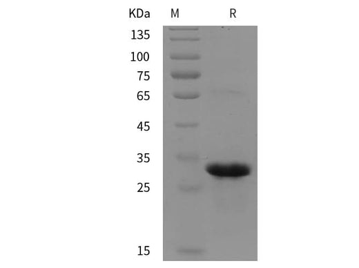 SDS-PAGE analysis of Human RAB5B proteins, 2 μg/lane of Recombinant Human RAB5B proteins was resolved with SDS-PAGE under reducing conditions, showing bands at 30 kDa.