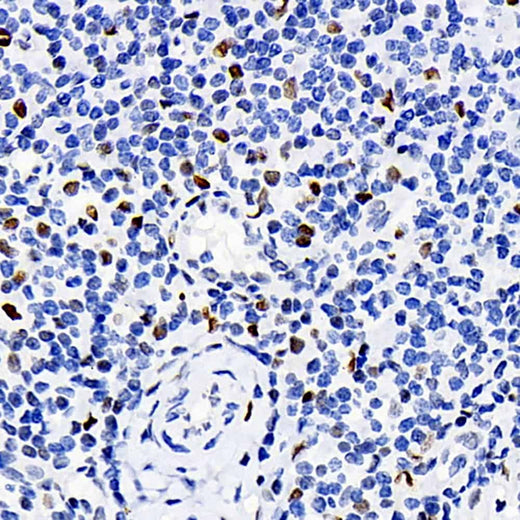 Immunohistochemistry analysis of paraffin-embedded human tonsil using ERK 2 Polyclonal Antibody at dilution of 1:100.