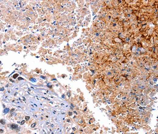 Anti-Human/Mouse/Rat HMOX1 Antibody