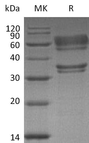 Recombinant Human HGF Protein (His Tag) - ABMIUM