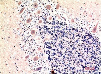 Immunohistochemistry of paraffin-embedded Human brain tissue using MAP1LC3B Monoclonal Antibody at dilution of 1:200.