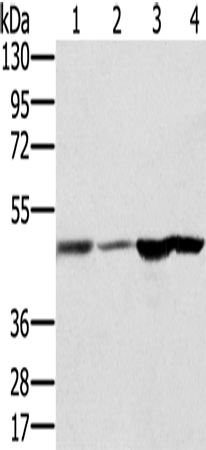 Anti-Human RNH1 Antibody - ABMIUM