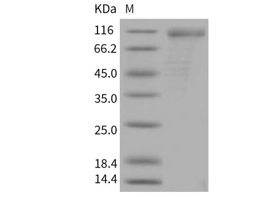 > 88 % as determined by reducing SDS-PAGE.