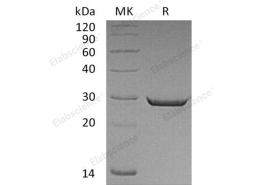 Recombinant Human HMGB2 Protein (His Tag) - ABMIUM