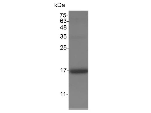 Recombinant Swine Flt-3 Ligand protein(His Tag) - ABMIUM