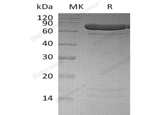 Recombinant Human PADI4 Protein (His Tag) - ABMIUM