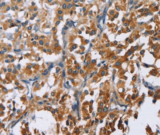 Anti-Human CARD9 Antibody - ABMIUM
