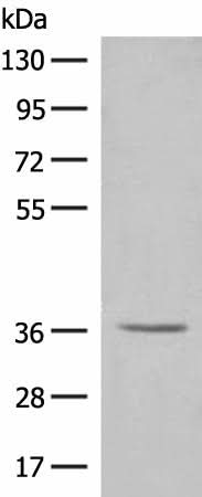 Anti-Human LGALS4 Antibody - ABMIUM