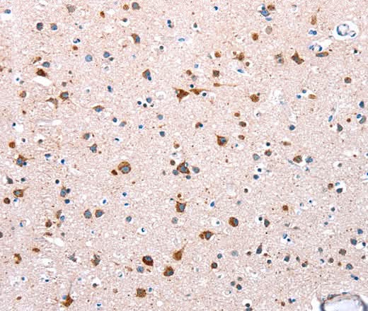 Anti-Human/Mouse NDUFA12 Antibody - ABMIUM