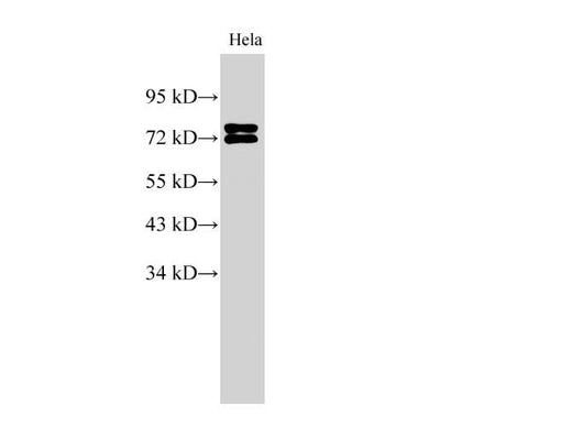 Anti-Human/Mouse LMNA Antibody - ABMIUM