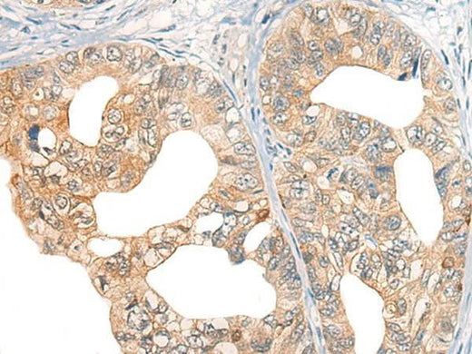 Anti-Human CORO2A Antibody - ABMIUM