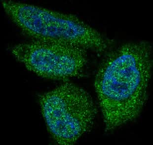 Anti-AKT1 Monoclonal Antibody Boster Bio