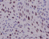 Anti-Cyclin D1 CCND1 Rabbit Monoclonal Antibody Boster Bio