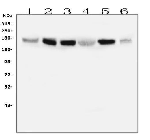 Anti-IRS1 Antibody Picoband® (monoclonal, 10I3 Boster Bio