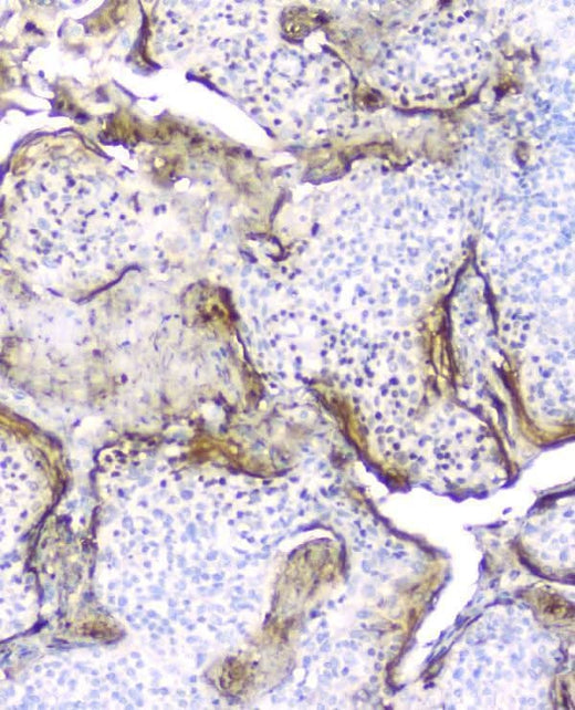 Anti-Elafin/Skalp PI3 Antibody (monoclonal, C7 Boster Bio