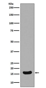 Anti-Survivin Birc5 Rabbit Monoclonal Antibody Boster Bio