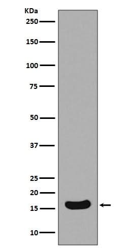 Anti-Survivin Birc5 Rabbit Monoclonal Antibody Boster Bio