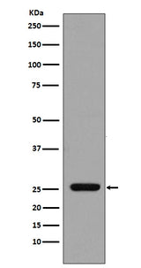 Anti-GST GSTP1 Rabbit Monoclonal Antibody Boster Bio