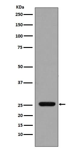 Anti-GST GSTP1 Rabbit Monoclonal Antibody Boster Bio