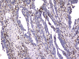 Anti-CD18 ITGB2 Antibody Picoband® (monoclonal, 1A3/2A10 Boster Bio