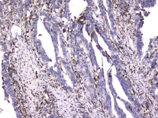 Anti-CD18 ITGB2 Antibody Picoband® (monoclonal, 1A3/2A10 Boster Bio