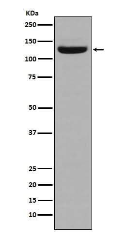 Anti-Collagen I COL1A1 Rabbit Monoclonal Antibody Boster Bio