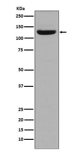 Anti-Collagen I COL1A1 Rabbit Monoclonal Antibody Boster Bio