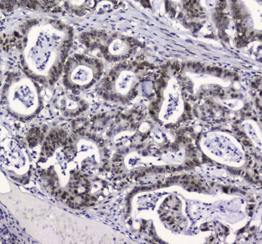 Anti-APE1 APEX1 Antibody Picoband® (monoclonal, 5C11 Boster Bio
