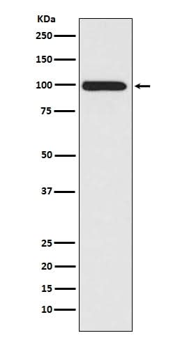 Anti-LRP1/Lrp 1 Cluster Ii Rabbit Monoclonal Antibody Boster Bio