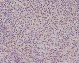 Anti-PMS2 Rabbit Monoclonal Antibody Boster Bio