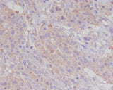 Anti-alpha smooth muscle Actin ACTA2 Rabbit Monoclonal Antibody Boster Bio