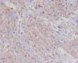 Anti-alpha smooth muscle Actin ACTA2 Rabbit Monoclonal Antibody Boster Bio