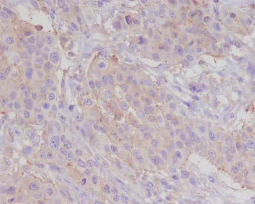 Anti-alpha smooth muscle Actin ACTA2 Rabbit Monoclonal Antibody Boster Bio