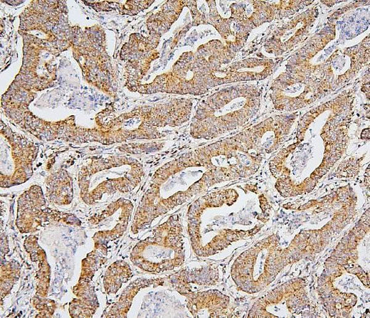 Anti-BAK/BAK1 Antibody Picoband® (monoclonal, 4C2 Boster Bio