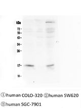 Anti-FHIT Antibody Picoband® (monoclonal, 26H7 Boster Bio