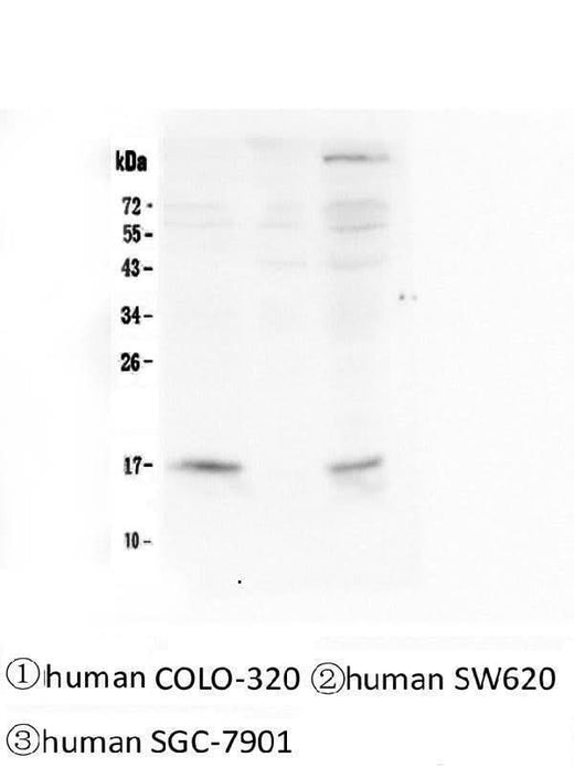 Anti-FHIT Antibody Picoband® (monoclonal, 26H7 Boster Bio