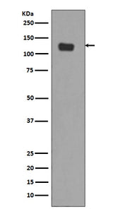Anti-Integrin alpha 6 ITGA6 Rabbit Monoclonal Antibody Boster Bio