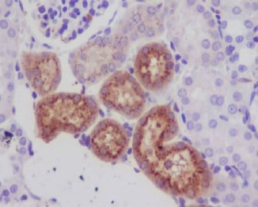 Anti-Lysozyme LYZ Rabbit Monoclonal Antibody Boster Bio