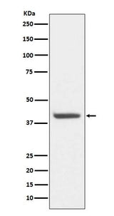 Anti-HDAC8/Histone Deacetylase 8 Rabbit Monoclonal Antibody Boster Bio