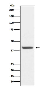 Anti-HDAC8/Histone Deacetylase 8 Rabbit Monoclonal Antibody Boster Bio
