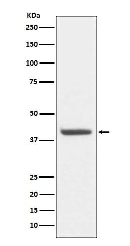 Anti-HDAC8/Histone Deacetylase 8 Rabbit Monoclonal Antibody Boster Bio