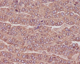 Anti-beta III Tubulin TUBB3 Rabbit Monoclonal Antibody Boster Bio